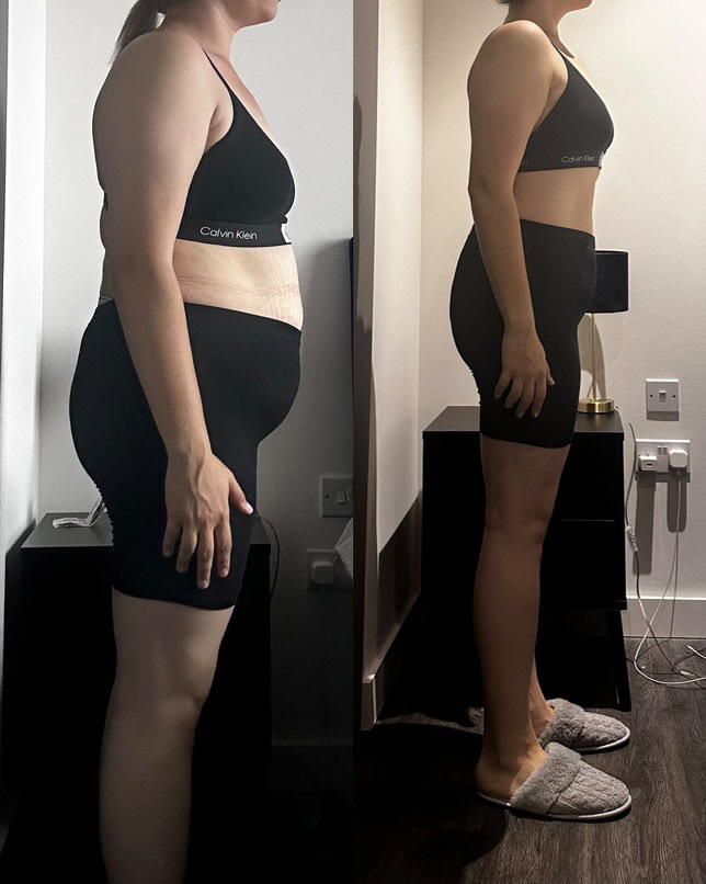 Female client side-view transformation showing fat loss progress with Gerald Fitness